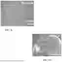 Fig. 17 - Genetically Engineered Phagocytes, and Related Compositions, Vectors, Methods and Systems