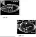 Fig. 18 - Genetically Engineered Phagocytes, and Related Compositions, Vectors, Methods and Systems
