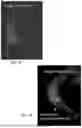 Fig. 19 - Genetically Engineered Phagocytes, and Related Compositions, Vectors, Methods and Systems