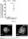 Fig. 20 - Genetically Engineered Phagocytes, and Related Compositions, Vectors, Methods and Systems