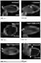 Fig. 24 - Genetically Engineered Phagocytes, and Related Compositions, Vectors, Methods and Systems