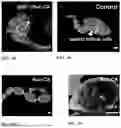 Fig. 26 - Genetically Engineered Phagocytes, and Related Compositions, Vectors, Methods and Systems