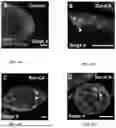 Fig. 29 - Genetically Engineered Phagocytes, and Related Compositions, Vectors, Methods and Systems