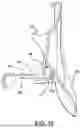 Fig. 12 - DIAPHRAGM FOR A BREAST PUMP AND A BREAST PUMP HAVING THE DIAPHRAGM