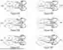 Fig. 15 - IL-10 VARIANT MOLECULES AND METHODS FOR TREATING INFLAMMATORY DISEASE AND ONCOLOGY