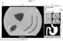 Fig. 08 - IMAGE PROCESSING APPARATUS AND ENDOSCOPE SYSTEM