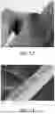 Fig. 14 - METHODS OF REDUCING OCCURRENCES OF SHORT CIRCUITS AND/OR LITHIUM PLATING IN BATTERIES