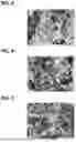 Fig. 04 - NEGATIVE ELECTRODE COLLECTOR AND CAN-TYPE SECONDARY BATTERY