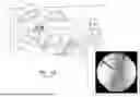 Fig. 02 - APPARATUS AND METHODS FOR USE WITH IMAGE-GUIDED SKELETAL PROCEDURES