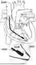 Fig. 01 - CARDIAC LEAD EXTRACTION DEVICE