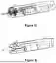 Fig. 16 - CARDIAC LEAD EXTRACTION DEVICE