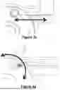 Fig. 22 - CARDIAC LEAD EXTRACTION DEVICE