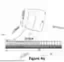 Fig. 33 - CARDIAC LEAD EXTRACTION DEVICE