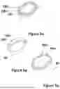 Fig. 47 - CARDIAC LEAD EXTRACTION DEVICE
