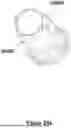 Fig. 77 - CARDIAC LEAD EXTRACTION DEVICE