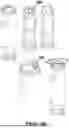 Fig. 86 - CARDIAC LEAD EXTRACTION DEVICE