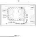 Fig. 12 - METHODS AND APPARATUS FOR SELECTIVE TISSUE ABLATION