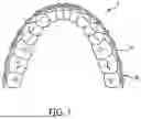 Fig. 02 - PLASTIC SPLINTS OR ALIGNERS FOR USE IN THE TREATMENT OF MALOCCLUSIONS BASED ON FORCE MEASUREMENT