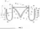 Fig. 03 - PROSTHETIC VALVES WITH EVERTING ANCHORS