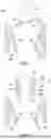 Fig. 07 - PROSTHETIC VALVES WITH EVERTING ANCHORS
