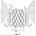 Fig. 09 - PROSTHETIC VALVES WITH EVERTING ANCHORS