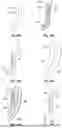 Fig. 22 - PROSTHETIC VALVES WITH EVERTING ANCHORS