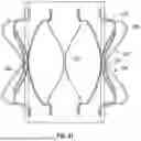 Fig. 32 - PROSTHETIC VALVES WITH EVERTING ANCHORS