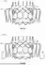 Fig. 43 - PROSTHETIC VALVES WITH EVERTING ANCHORS