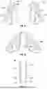 Fig. 47 - PROSTHETIC VALVES WITH EVERTING ANCHORS