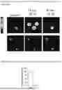 Fig. 07 - ADDRESSING INJECTION SITE REACTIONS ASSOCIATED WITH THE ADMINISTRATION OF ELAMIPRETIDE