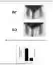 Fig. 08 - ADDRESSING INJECTION SITE REACTIONS ASSOCIATED WITH THE ADMINISTRATION OF ELAMIPRETIDE