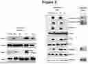 Fig. 06 - METHOD FOR THE TREATMENT OF PATIENTS WITH CARCINOMAS