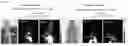 Fig. 87 - METHODS AND MATERIALS FOR COMBINING BIOLOGICS WITH MULTIPLE CHELATORS