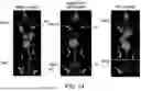 Fig. 16 - DIMERIZATION STRATEGIES AND COMPOUNDS FOR MOLECULAR IMAGING AND/OR RADIOIMMUNOTHERAPY