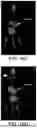 Fig. 20 - DIMERIZATION STRATEGIES AND COMPOUNDS FOR MOLECULAR IMAGING AND/OR RADIOIMMUNOTHERAPY