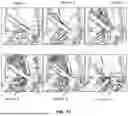 Fig. 15 - DYNAMIC BALE CREATION