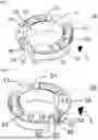 Fig. 06 - Centering Ring; Method for Reducing the Risk of Breakage of at Least One Thin-Walled Region of a Centering Ring