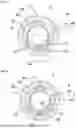 Fig. 10 - Centering Ring; Method for Reducing the Risk of Breakage of at Least One Thin-Walled Region of a Centering Ring
