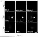 Fig. 02 - SELECTIVE TARGETING OF OLIGOMERIC B-AMYLOID