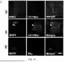 Fig. 04 - SELECTIVE TARGETING OF OLIGOMERIC B-AMYLOID