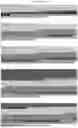 Fig. 16 - CHIMERIC ANTIGEN RECEPTOR