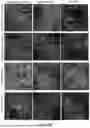 Fig. 19 - RPE CELL POPULATIONS AND METHODS OF GENERATING SAME