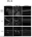 Fig. 25 - RPE CELL POPULATIONS AND METHODS OF GENERATING SAME