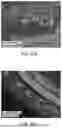 Fig. 30 - RPE CELL POPULATIONS AND METHODS OF GENERATING SAME