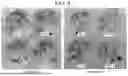 Fig. 07 - COMPOSITIONS AND METHODS FOR TRANSFORMATION OF MONOCOT SEED EXCISED EMBRYO EXPLANTS