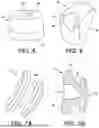 Fig. 04 - EXPANSION PLUG AND SYSTEM AND METHOD EMPLOYING SAME