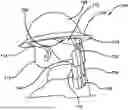 Fig. 01 - Neck Protection Device