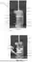 Fig. 04 - CHEESE GRATER HOPPERS, APPARATUSES AND METHODS OF USING THE SAME