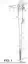 Fig. 02 - MEDICAL DEVICES INCLUDING ARTICULATION JOINTS AND ASSOCIATED METHODS OF ASSEMBLY