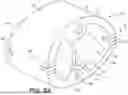 Fig. 08 - MEDICAL DEVICES INCLUDING ARTICULATION JOINTS AND ASSOCIATED METHODS OF ASSEMBLY
